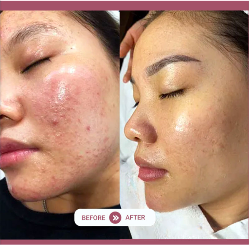 Chăm sóc và điều trị da