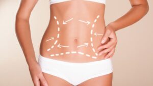 Bảng giá hút mỡ toàn thân 2026:Tổng hợp chi phí trọn gói và ưu đãi combo nhiều vùng 2026