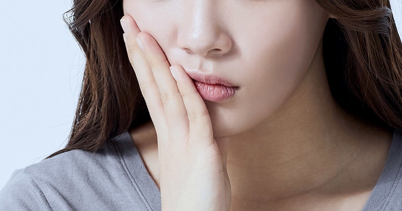 Hình ảnh nhận biết dấu hiệu nhiễm trùng vết mổ sau gọt hàm với biểu hiện sưng đỏ khu trú và rò dịch mủ.