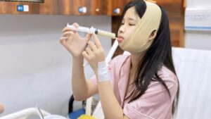 Gọt hàm có ảnh hưởng ăn nhai không? Lộ trình hồi phục 4 giai đoạn và lưu ý từ bác sĩ