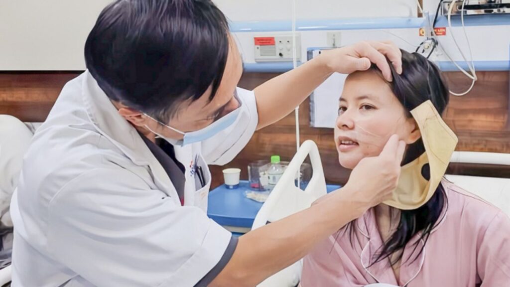 Hạ gò má bao lâu hết sưng? Mốc giảm sưng, vào form và ổn định sau phẫu thuật