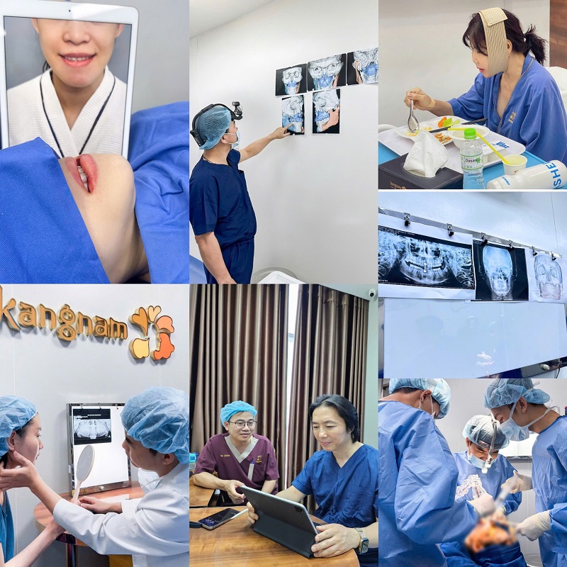 Hiện tại Kangnam ứng dụng đa dạng công nghệ thẩm mỹ, rút mang lại kết quả tối ưu cho khách hàng