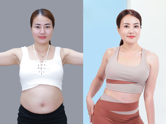 ảnh trước sau của khách hàng giảm mỡ tại kangnam, khách tự tin hơn với vóc dáng mới