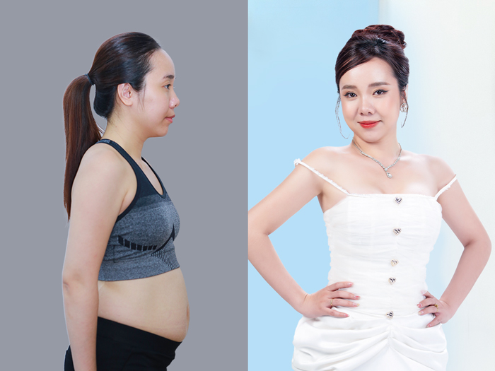 ảnh trước sau của khách hàng giảm mỡ tại kangnam, sở hữu vòng eo thon gọn