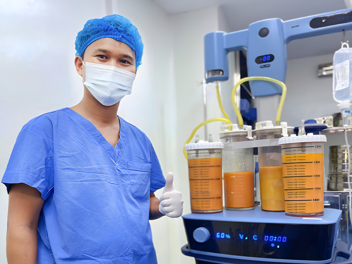 Lipo 360 dùng sóng siêu âm tác động vào mô mỡ bụng