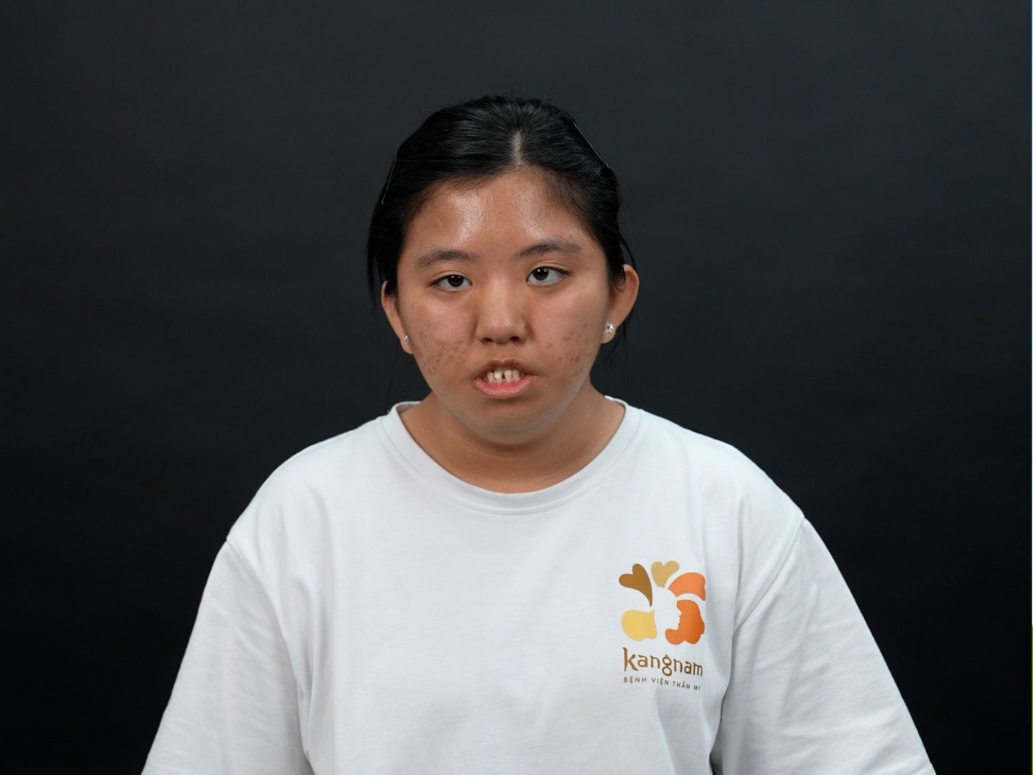 Ngoại hình của Kim Ngân khi đến với Hành trình Lột xác