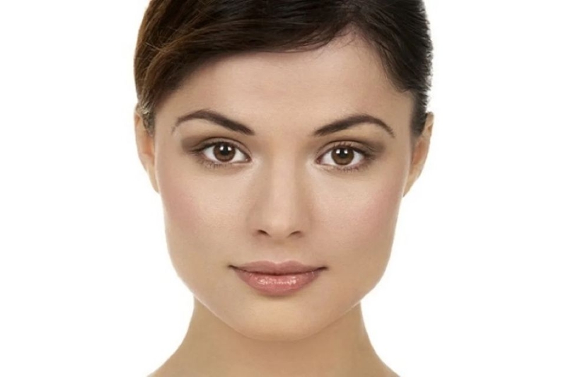 Mặt vuông to do xương hàm bè, to bạnh