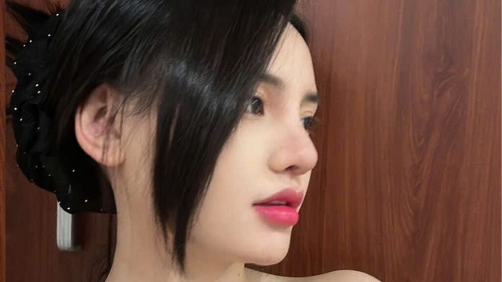 Nâng mũi sờ vào có biết không? Giải mã 5 dấu hiệu mũi lộ và kỹ thuật giấu sẹo thẩm mỹ