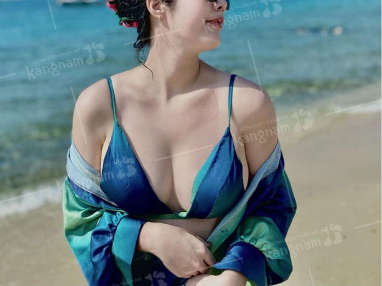 Nâng ngực 3 tháng có thể thoải mái bơi lội