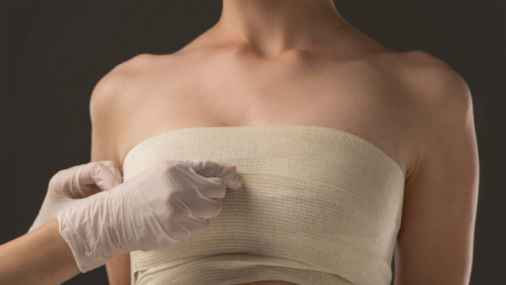 Nâng ngực bao lâu hết sưng? Phác đồ 4 giai đoạn hồi phục giúp ngực nhanh mềm, chuẩn form