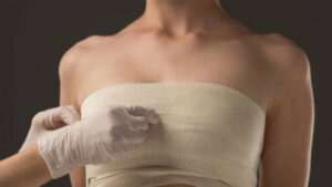 Nâng ngực bao lâu hết sưng? Phác đồ 4 giai đoạn hồi phục giúp ngực nhanh mềm, chuẩn form