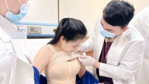 Nâng ngực bao lâu hồi phục? Lộ trình 30 ngày ổn định và bí quyết đẹp tự nhiên