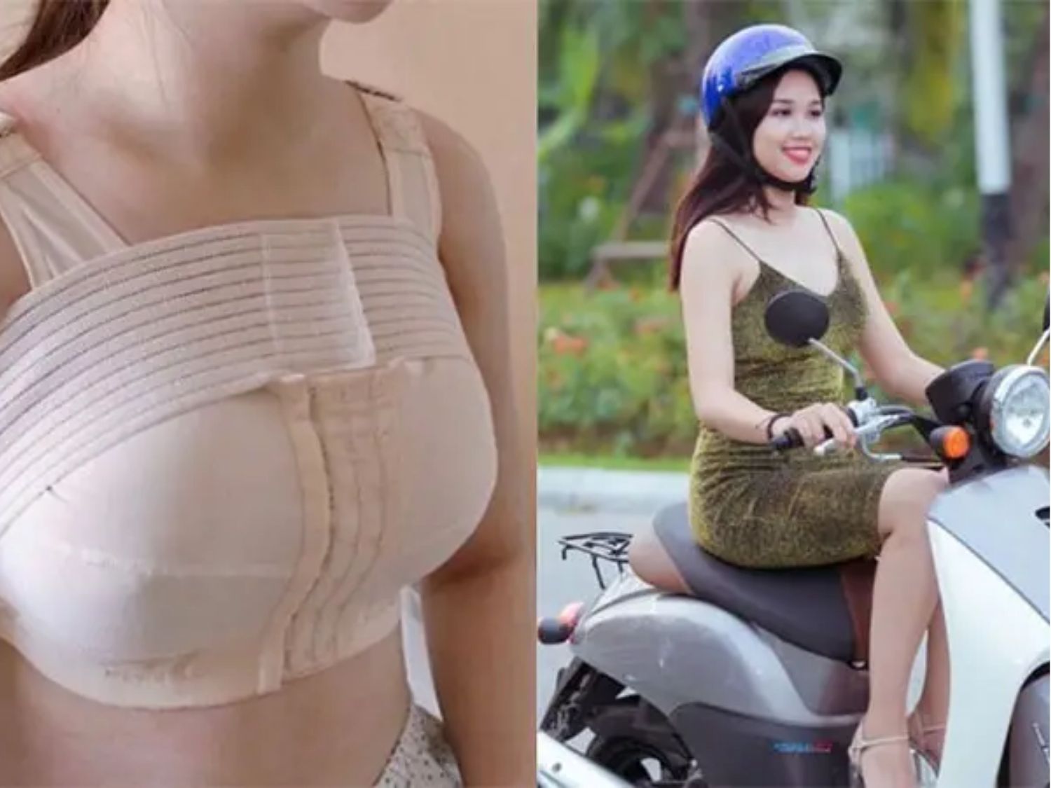 khách hàng sau nâng ngực nên kiêng lái xe trong thời gian đầu, đến khi ngực ổn định hơn có thể lái xe