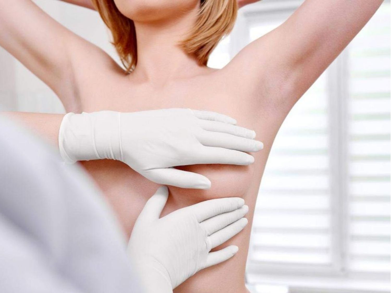 ngực lệch rõ sau phẫu thuật cần chỉnh sửa lại