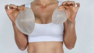 Nâng ngực có bị lộ túi không? Nguyên nhân và 5 cách khắc phục triệt để