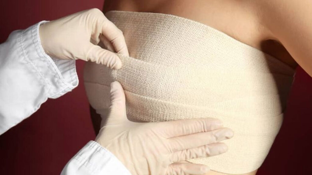 Nâng ngực có cần băng ép không? Lợi ích & Thời điểm tháo băng