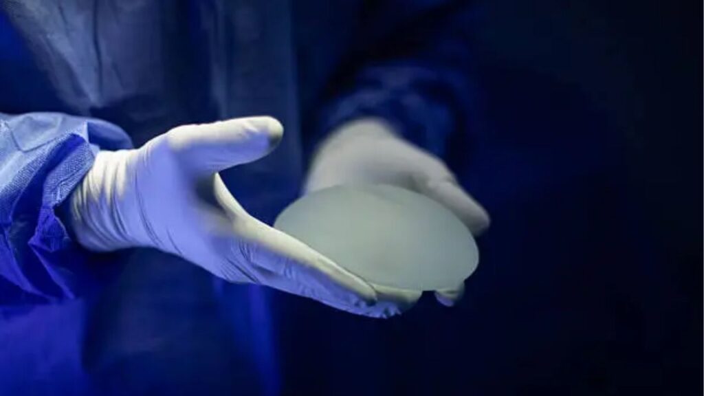 Nâng ngực bao lâu phải thay túi? 5 dấu hiệu cảnh báo cần kiểm tra ngay