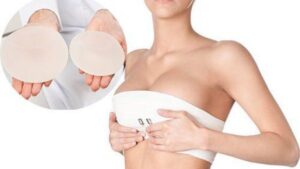 Đặt túi ngực dưới cơ có đau hơn không? Lộ trình 7 ngày giảm đau thần tốc