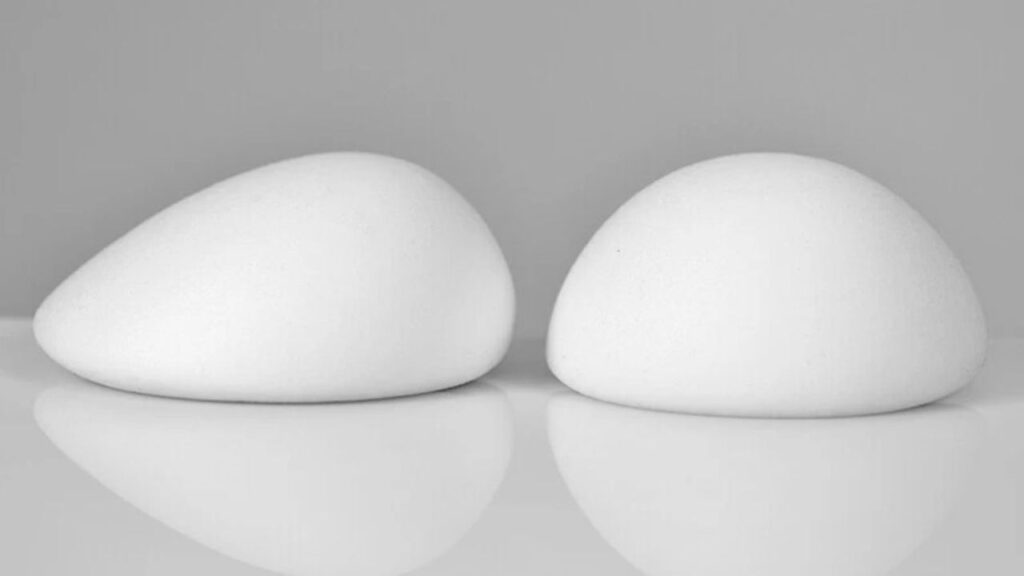 Nâng ngực túi giọt nước giá bao nhiêu? Bảng giá túi Mentor và Motiva tạo dáng tự nhiên 2026