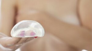 Nâng ngực sau sinh có an toàn không? Thời điểm vàng và 5 lưu ý từ chuyên gia