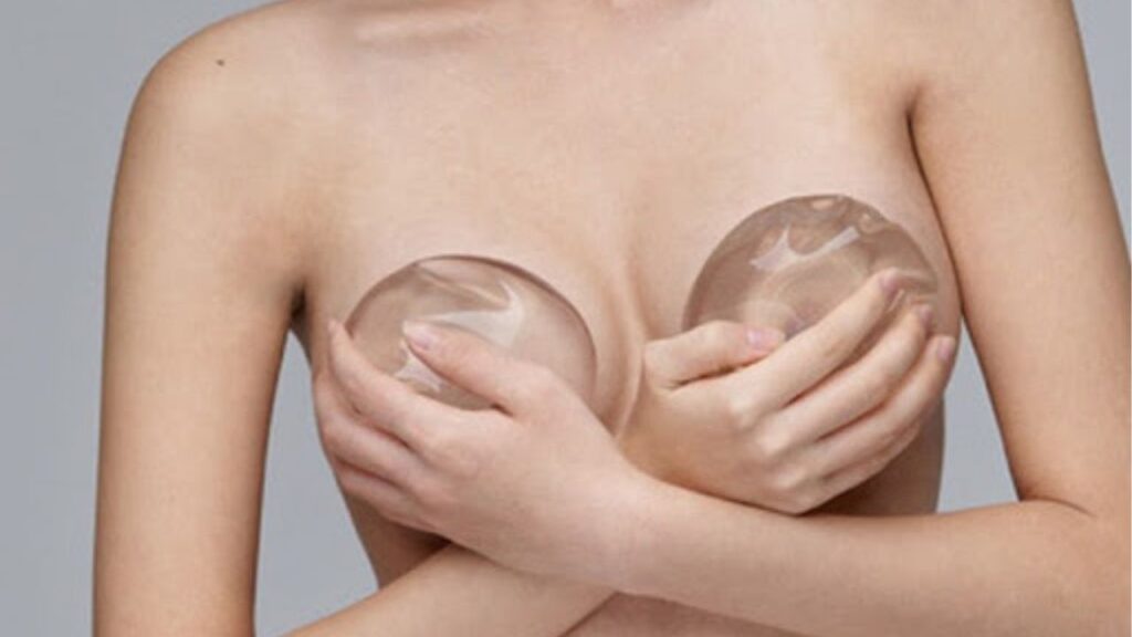 Nâng ngực sau sinh nên chọn phương pháp nào? 7 kinh nghiệm phục hồi vòng 1 chảy xệ