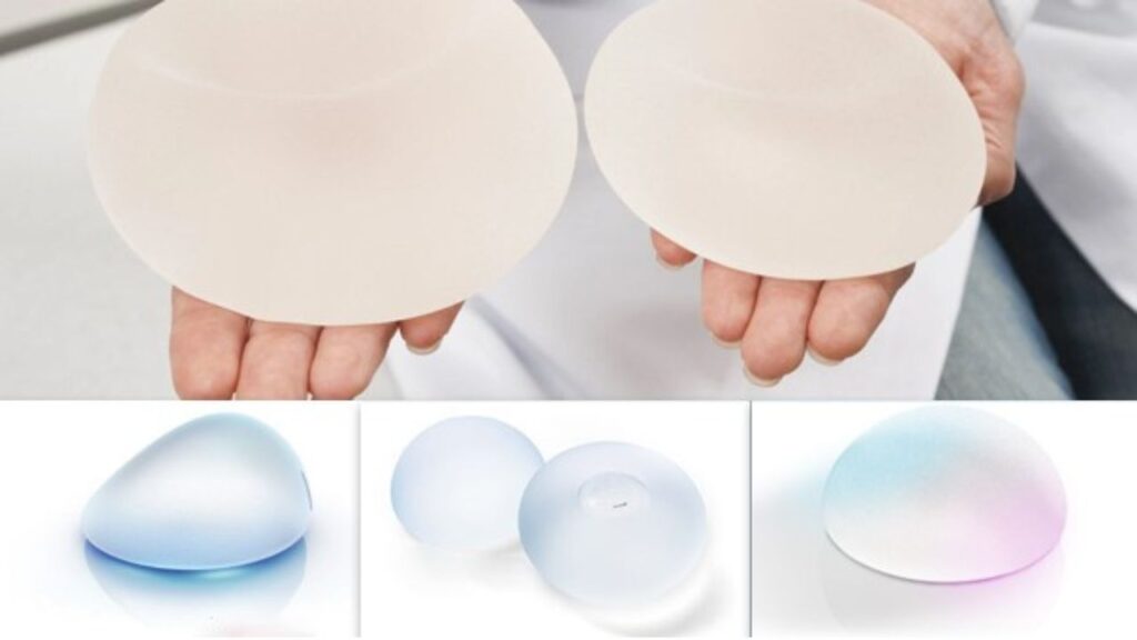 Nên chọn túi ngực hãng nào? So sánh 4 thương hiệu mềm, bền và ít bao xơ nhất