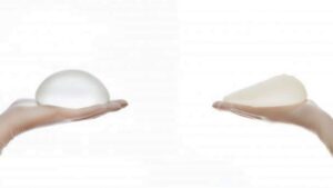 Nên chọn túi tròn hay túi giọt nước? 5 tiêu chí vàng chọn dáng ngực chuẩn xác