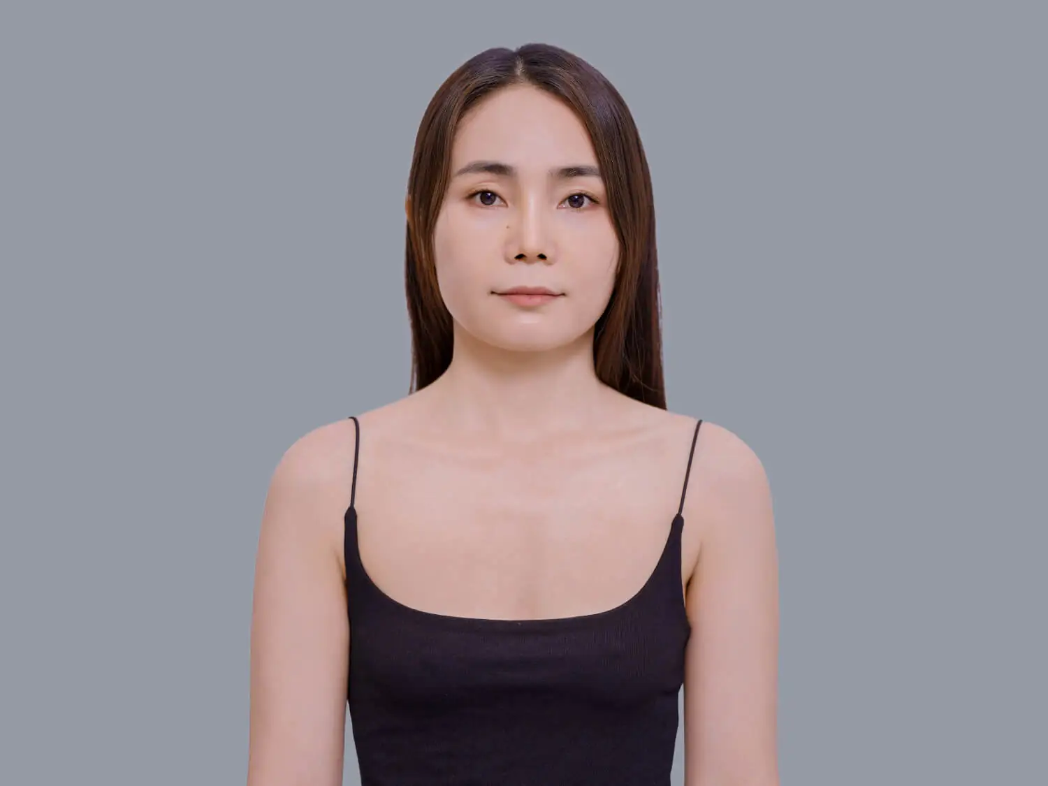 Tình trạng ngực xẹp lép, chảy xệ sau khi sinh do Dây chằng giữ phom ngực bị căng giãn quá mức