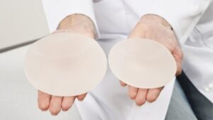 Tư vấn size túi ngực cho người cao 1m55: 250cc hay 300cc là đẹp nhất?