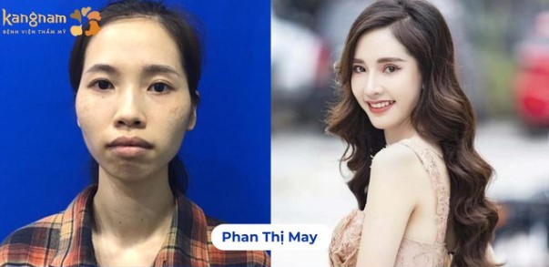 Từ cô gái tự ti vì gò má cao, mặt hốc hác, May đã trở nên xinh đẹp, tự tin như một hotgirl