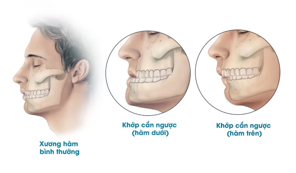 Các tình trạng cần phẫu thuật hàm mặt