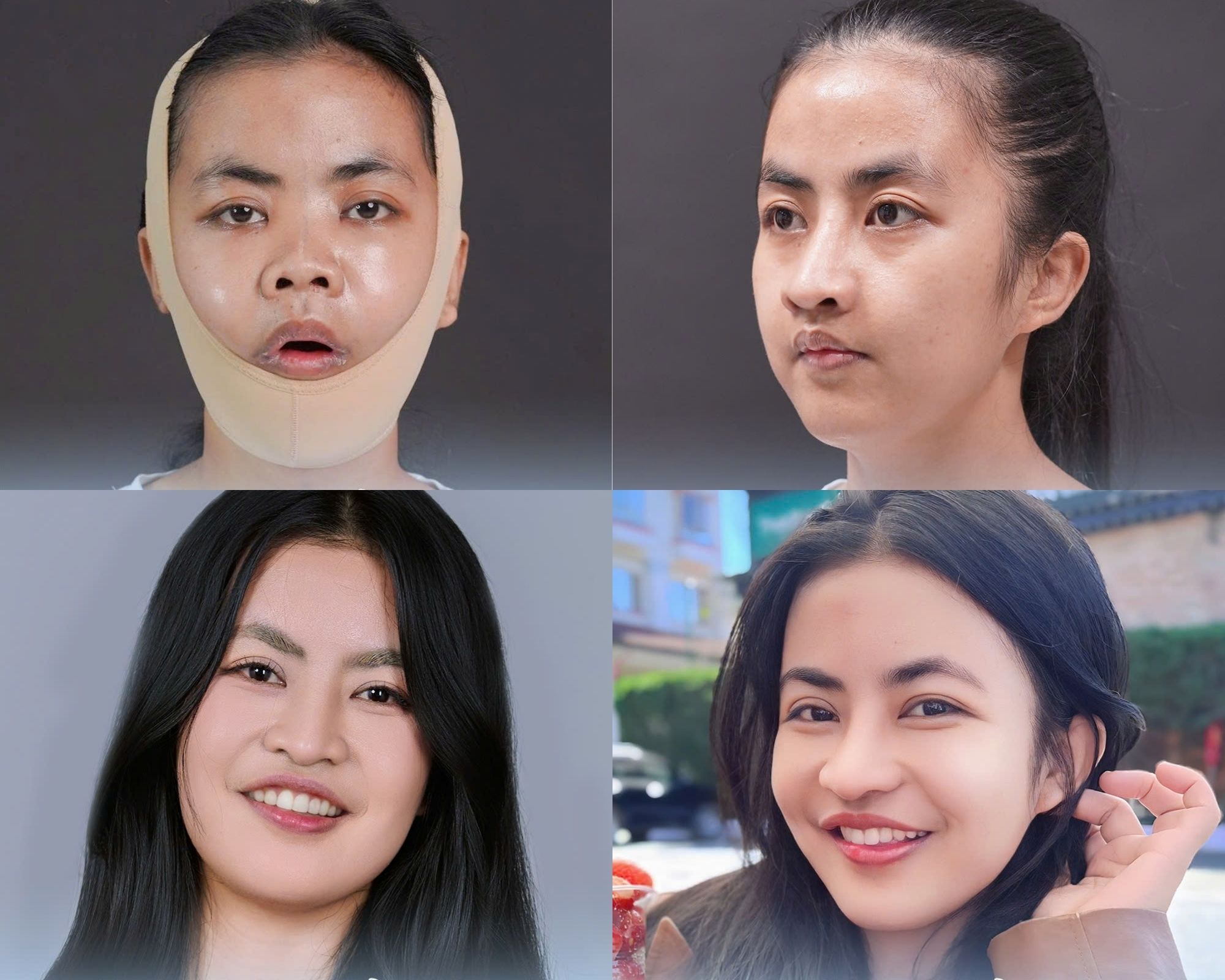 Quá trình phục hồi ổn định của Trà My sau 120 ngày