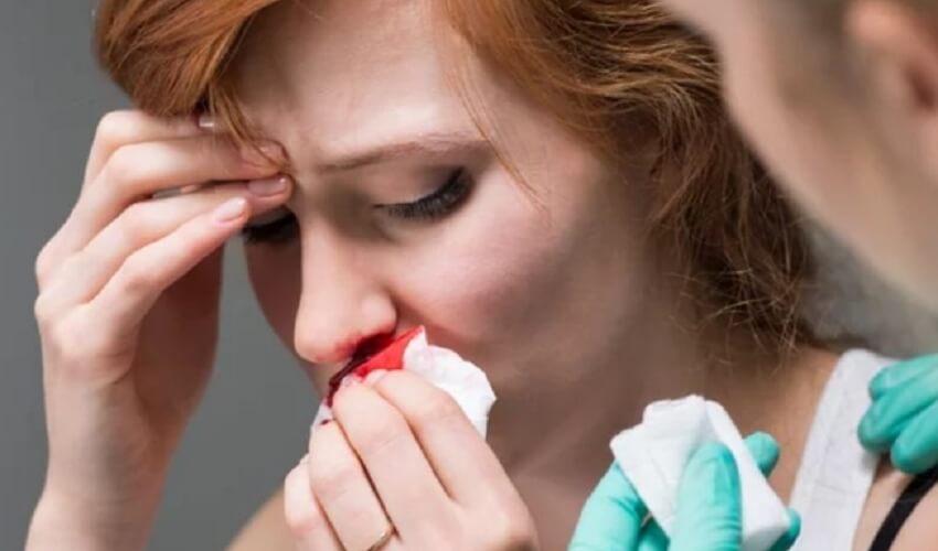 Người mắc các bệnh rối loạn đông máu, tim mạch không nên chỉnh hàm hô