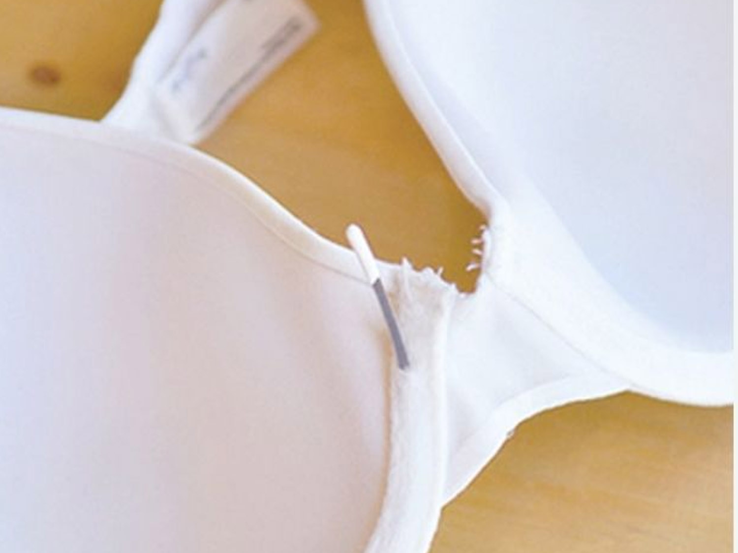 Gọng áo ngực lòi ra ngoài có thể không tốt sau nâng ngực