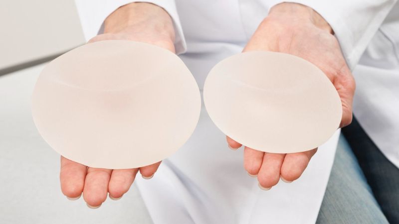 Túi ngực vừa vặn với vóc dáng cơ thể giúp nâng tầm nhan sắc