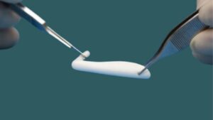 Sụn nâng mũi là gì? Review 6 loại sụn tốt nhất và Bí quyết chọn sụn vĩnh viễn