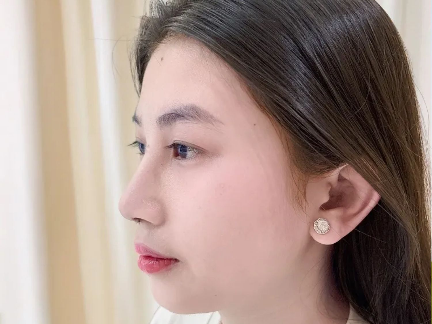 Khách hàng Thu Trang nâng mũi tại Bệnh viện Thẩm mỹ Kangnam Sài Gòn chia sẻ cảm giác nhẹ nhàng, không đau