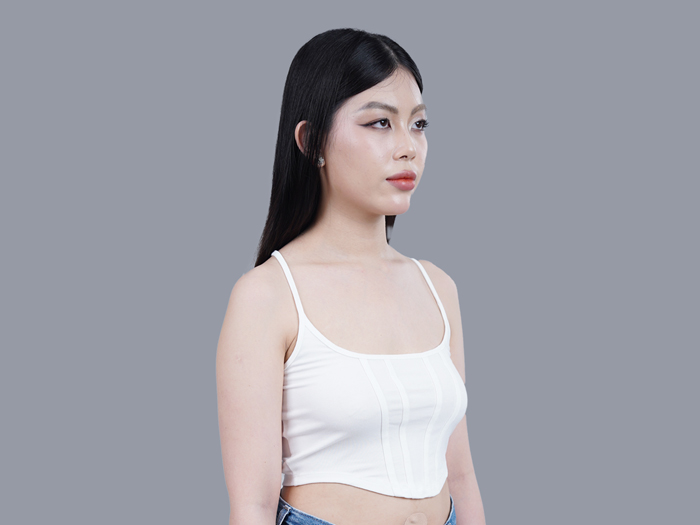 Khách hàng gặp tình trạng ngực phẳng, lép