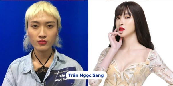 Quán quân HTLX 2018 ghi dấu với hành trình chuyển giới đầy dũng cảm và kết quả thẩm mỹ ấn tượng