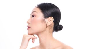 Trượt cằm bao lâu ổn định? Mốc hồi phục sau phẫu thuật