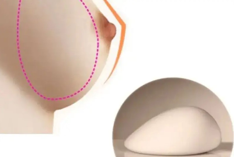 Túi giọt nước tạo độ mềm mại tự nhiên