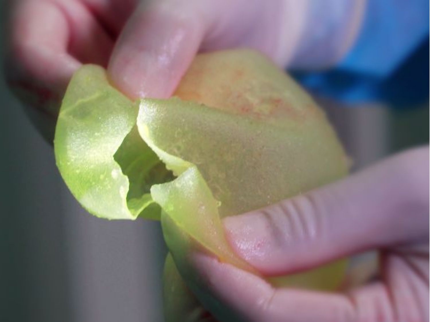 tình trạng vỡ túi ngực hiếm khi xảy ra, trừ khi có va đập lực quá mạnh mẽ