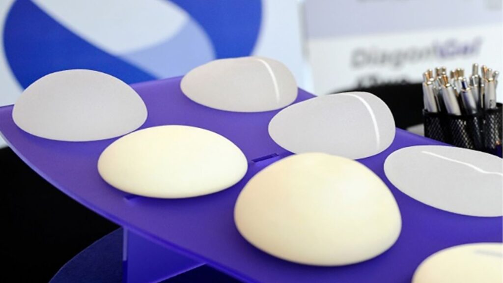 Túi ngực có dùng trọn đời không? Review tuổi thọ thực tế và mốc thay túi an toàn