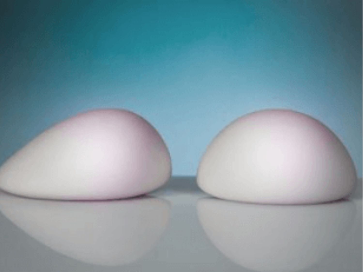 ảnh so sánh túi ngực dáng giọt nước và dáng tròn