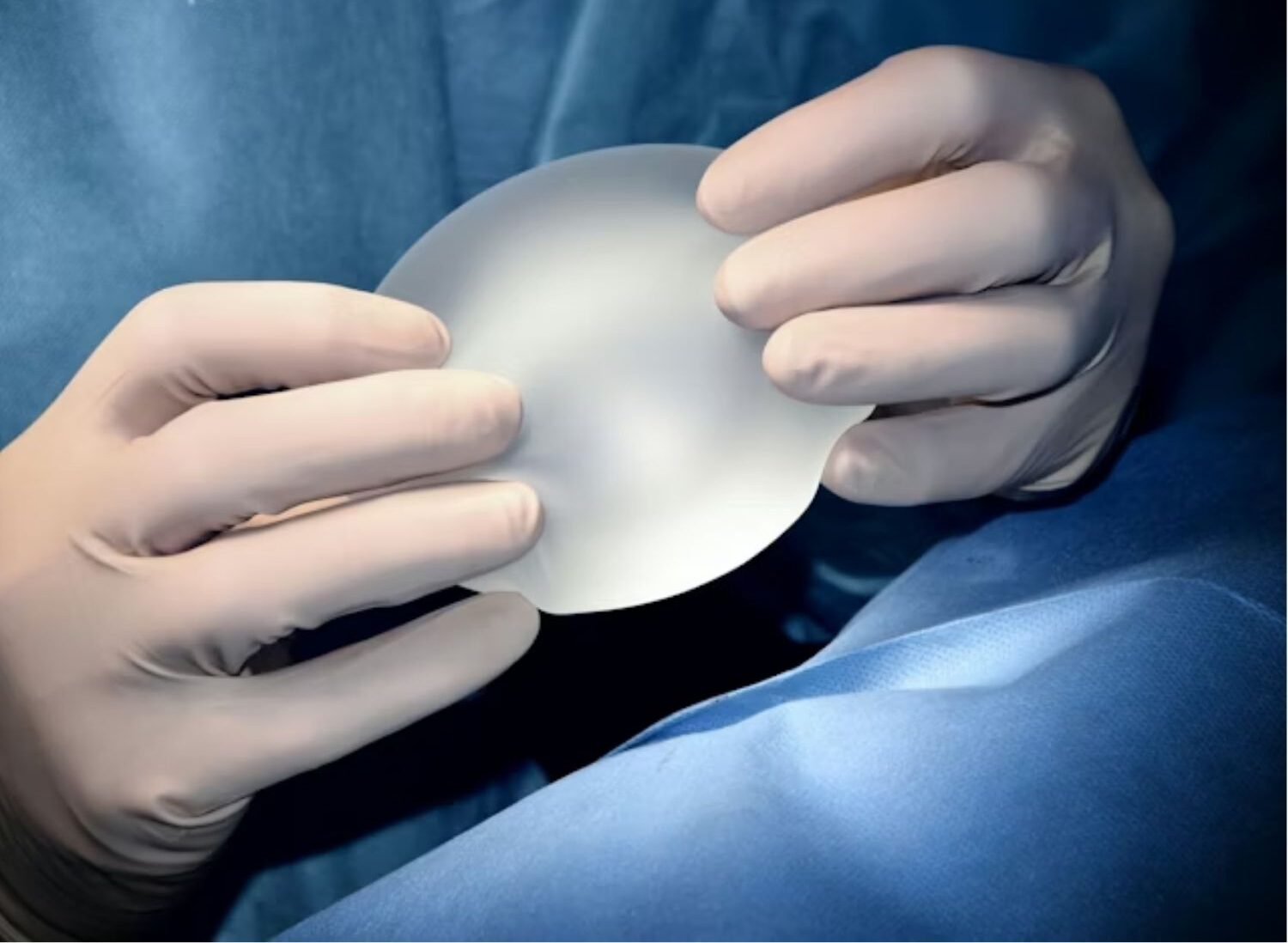 bác sĩ chuẩn bị thay túi ngực trong phòng vô trùng do khách hàng muốn đổi kích thước túi mới