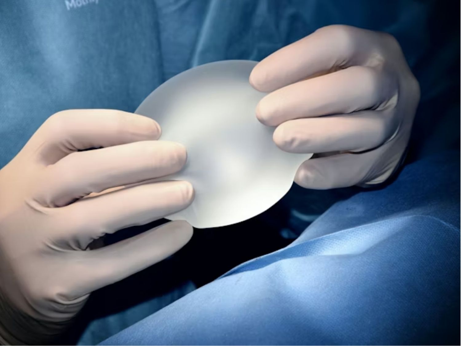 túi ngực không thể sử dụng vĩnh viễn mà không có sự thay đổi nào