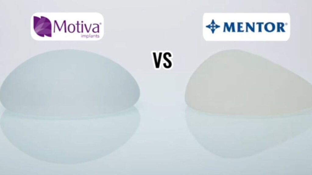 So sánh túi ngực Mentor và Motiva: Lựa chọn nào hoàn hảo cho vóc dáng của bạn