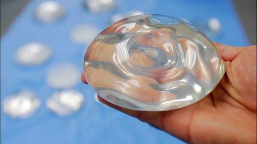 Túi ngực nước biển là gì? 6 Thông tin quan trọng giúp bạn lựa chọn đúng