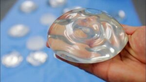 Túi ngực nước biển là gì? 6 Thông tin quan trọng giúp bạn lựa chọn đúng