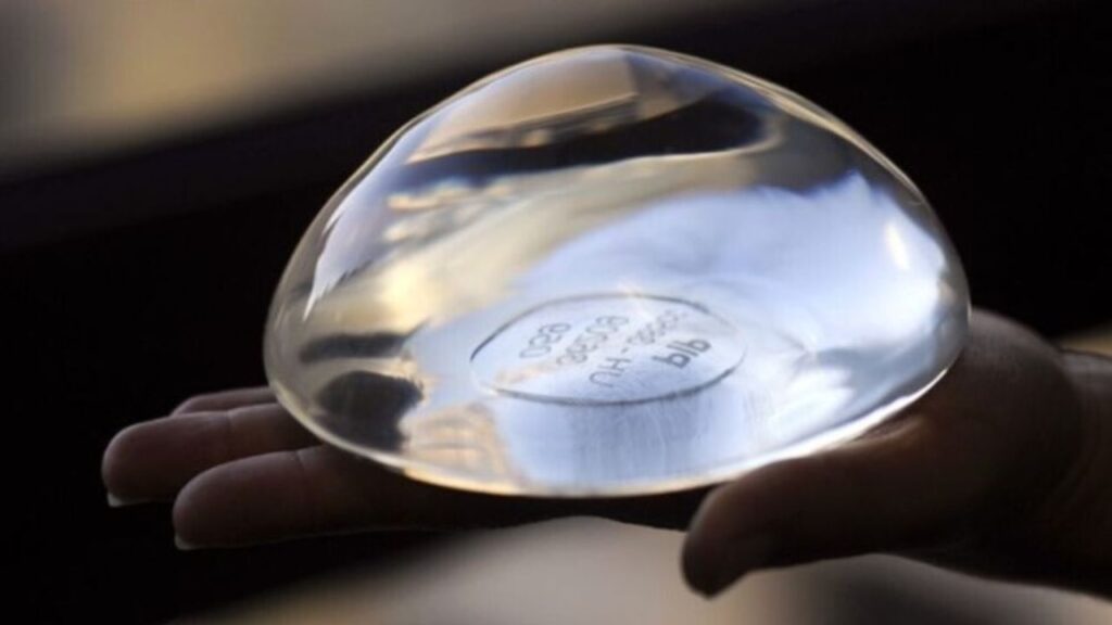 Túi trơn có an toàn không? So sánh độ bền và nguy cơ bao xơ với túi nhám